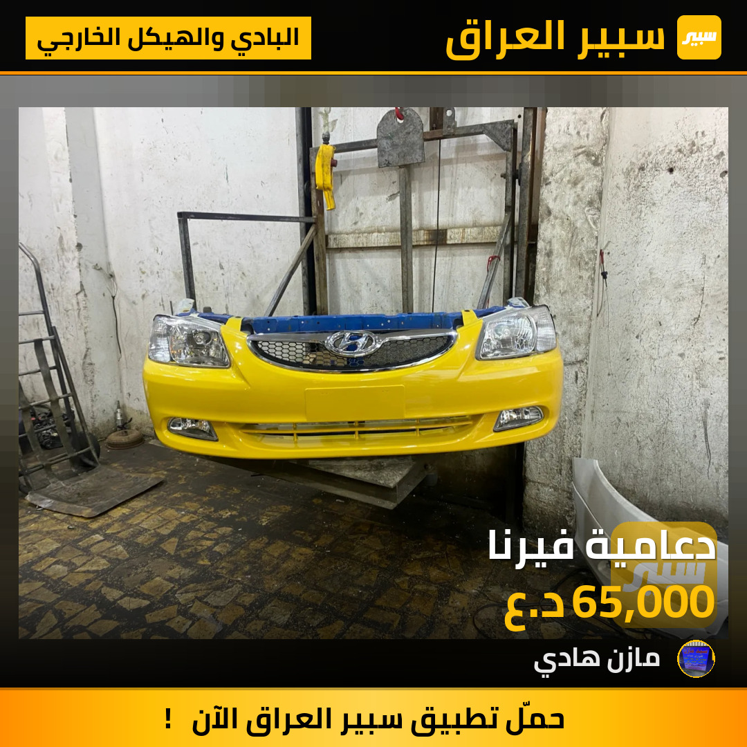 دعامية فيرنا | سبير